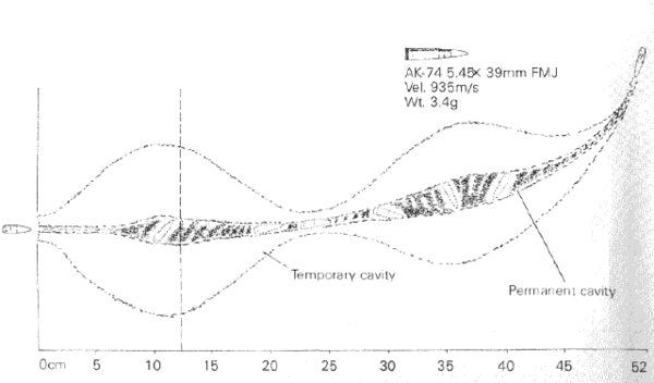 AK-74 5.45×39mm wound ballistics