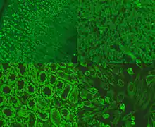 Picture of immunofluorescence staining pattern of AMA antibodies.