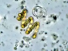 "Anabaena spiroides"