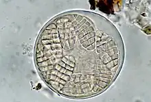 Photograph of an ascus from A. spectabile taken through a compound microscope (x1000), showing a ballon-shaped ascus containing eight, hyaline, muriform spores.