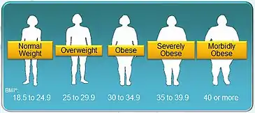 A chart showing BMI classification for obesity and overweight. Overweight or obese mothers have a higher risk of experiencing DOL.