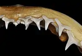 Upper teeth