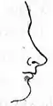 Rhinoplasty: Nasal Class VI. The celestial nose. (Nasology Eden Warwick, 1848)