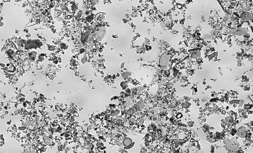 Diatomaceous earth consisting of centric (radially symmetric) and pennate (bilaterally symmetric) diatoms suspended in water.(click 3 times to fully enlarge)