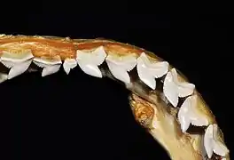 Upper teeth