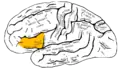 Lateral surface of left cerebral hemisphere, viewed from the side. (shown in orange).