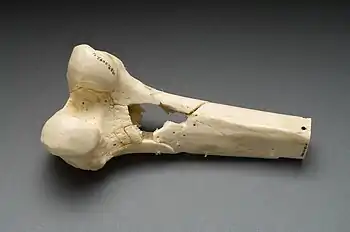 Femur bone with a hole caused by a bullet