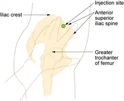 Ventrogluteal site