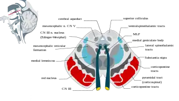 Cross-sectional anatomy of the midbrain showing location of the nucleus of the oculomotor nerve and the Edinger-Westphal nucleus