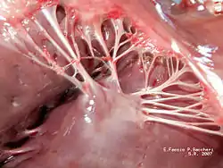 Papillary muscles and chordae tendineae