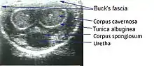 Medical ultrasonography of a normal penis