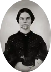 A black and white picture of a woman with a tattoo on her chin