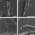 Male copulatory organ, scanning electron microscopy