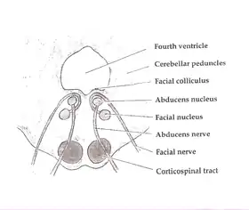 Cross section of the pons at the level of the facial colliculus. PPRF is not labeled, but is visible adjacent to the abducens nucleus