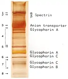 RBC membrane proteins separated by SDS-PAGE and silver-stained.