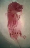 Red alizarin staining of rat's embryonic bones for osteogenesis study