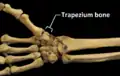 Right hand anterior view (palmar view). Thumb on top.