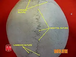 Sagittal suture.