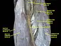 Muscles of Thigh. Anterior views.