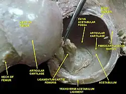 Hip joint. Lateral view. Acetabulum.