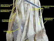 Muscles of hand. Posterior view.