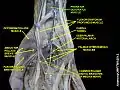 Pronator quadratus muscle