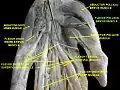 Flexor pollicis brevis muscle