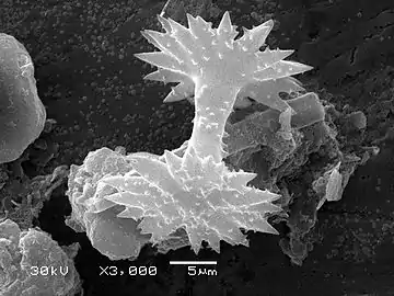 Spicules of sponge (SEM)