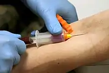 A vacutainer being used to draw blood from the median cubital vein for a blood test.